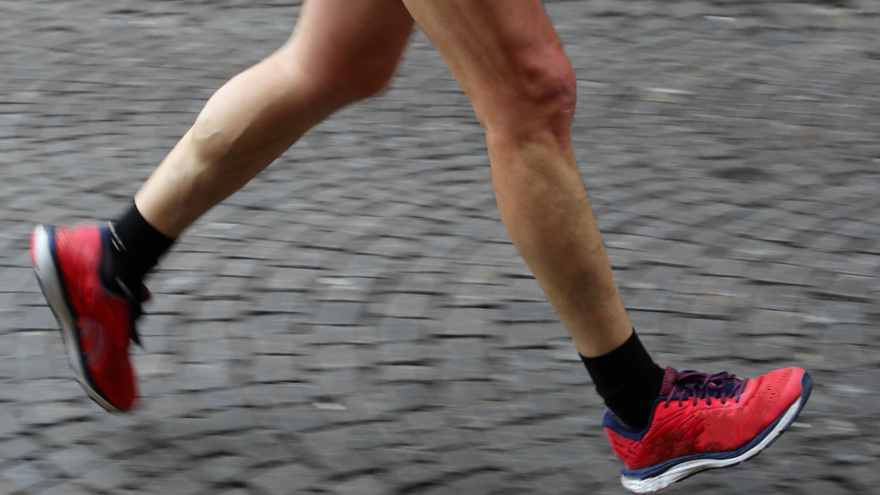 Common causes of shin splints including training errors, shoes, and lower leg overload