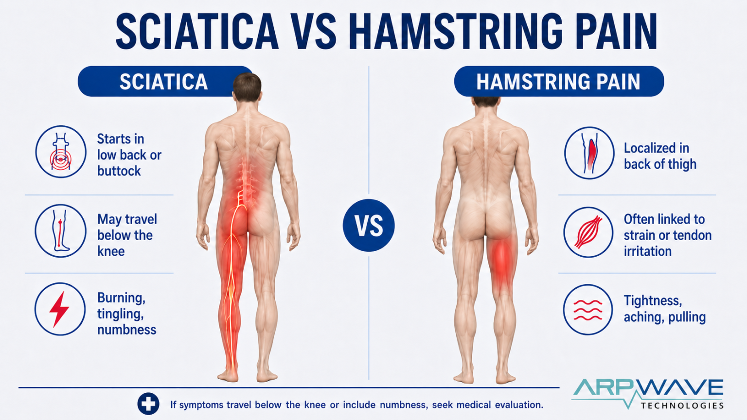 Hamstring Pain: Causes, Recovery Timeline, Exercises & ARPwave Therapy ...